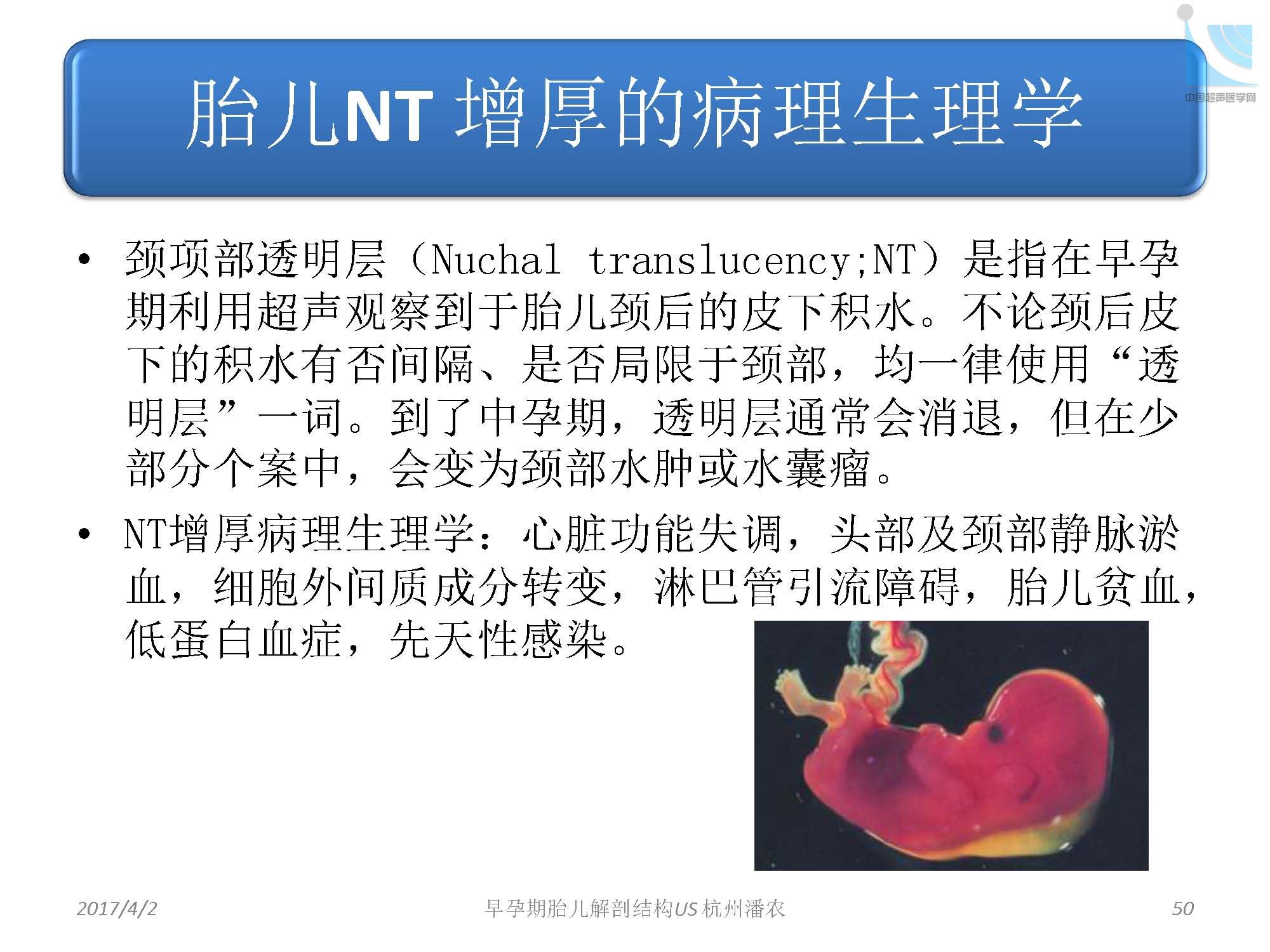 早孕期胎儿解剖结构超声检查及相关问题_页面_050.jpg