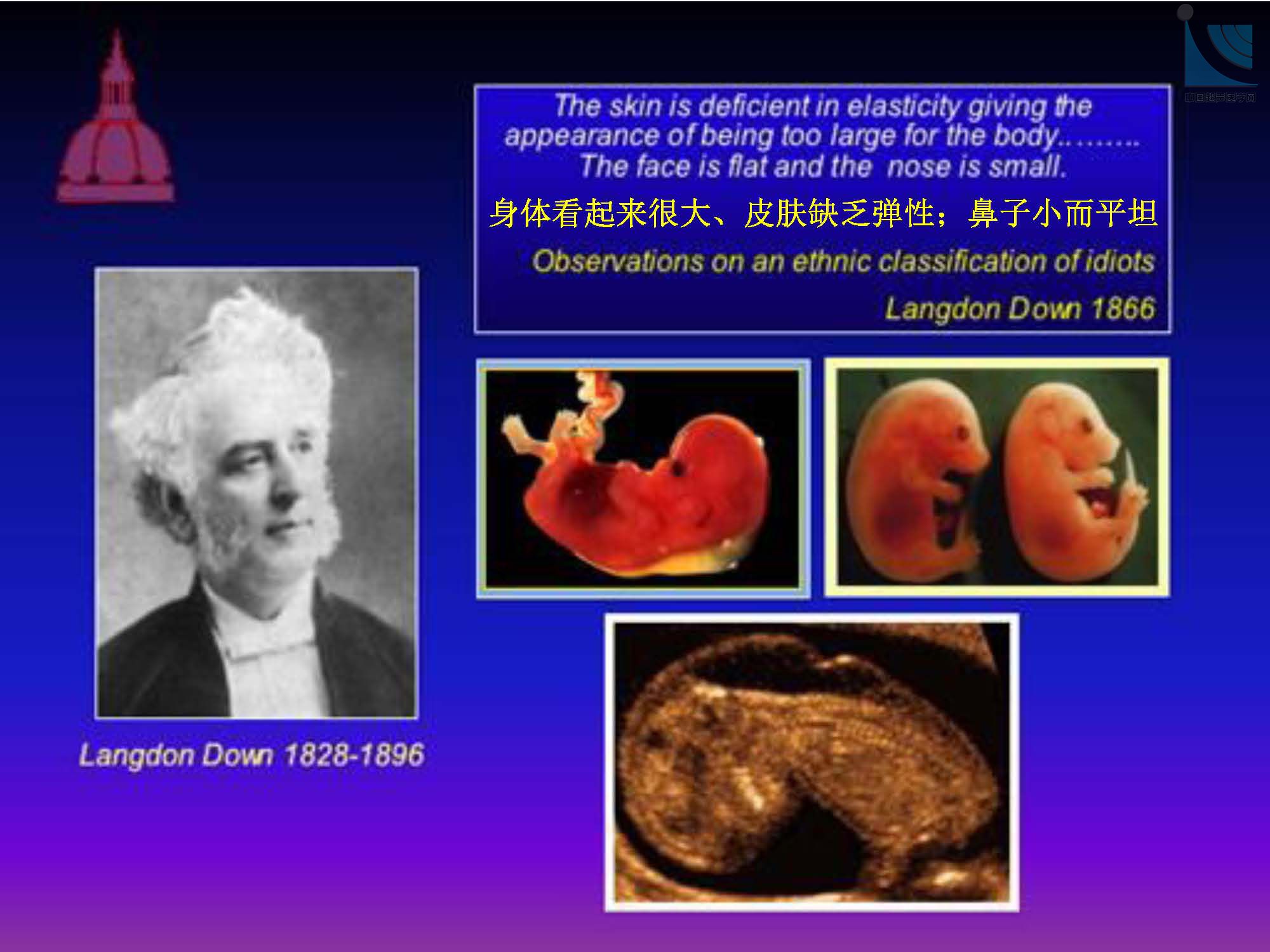 早孕期胎儿解剖结构超声检查及相关问题_页面_051.jpg