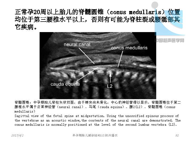 早孕期胎儿解剖结构超声检查及相关问题_页面_092.jpg