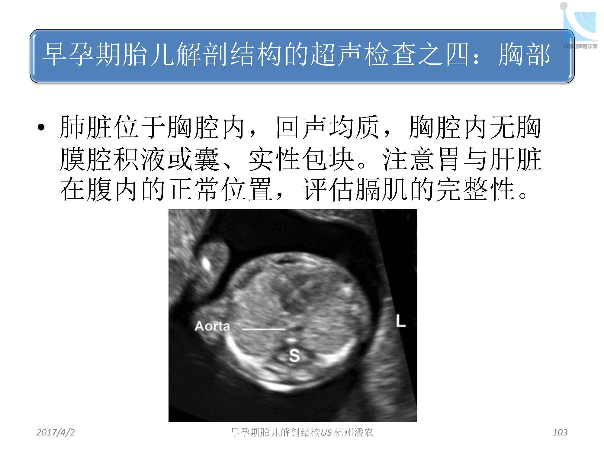 早孕期胎儿解剖结构超声检查及相关问题_页面_103.jpg